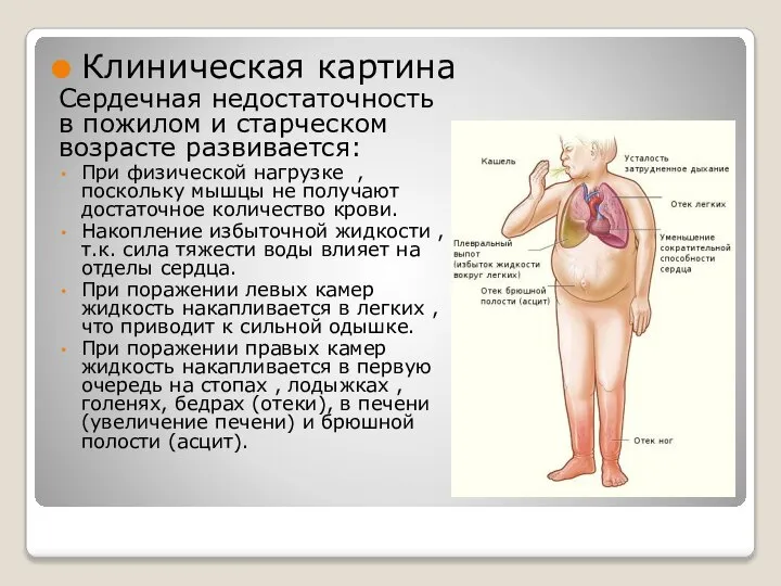 Клиническая картина Сердечная недостаточность в пожилом и старческом возрасте развивается: При физической