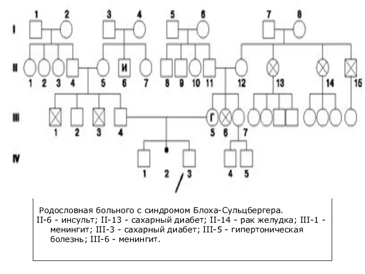 Родословная больного с синдромом Блоха-Сульцбергера. II-6 - инсульт; II-13 - сахарный диабет;