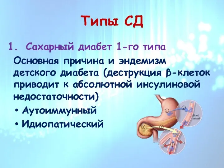 Типы СД Сахарный диабет 1-го типа Основная причина и эндемизм детского диабета