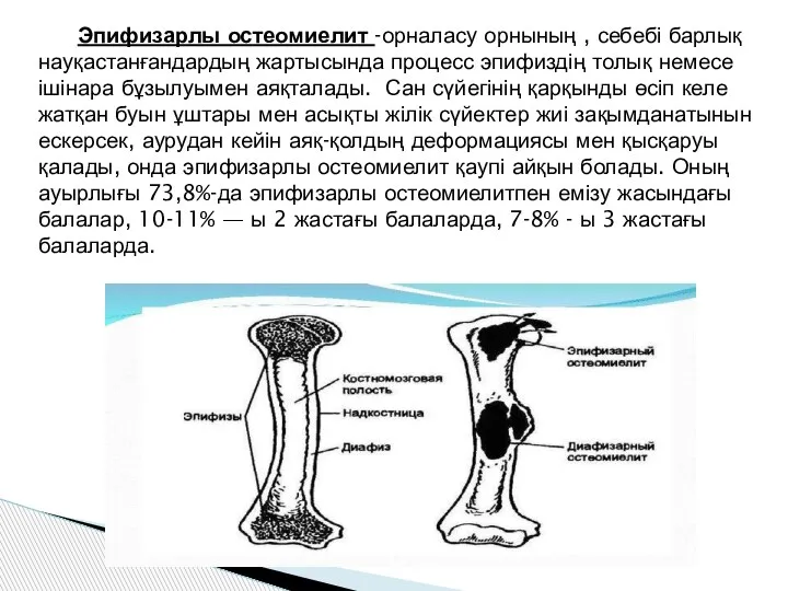 Эпифизарлы остеомиелит -орналасу орнының , себебі барлық науқастанғандардың жартысында процесс эпифиздің толық