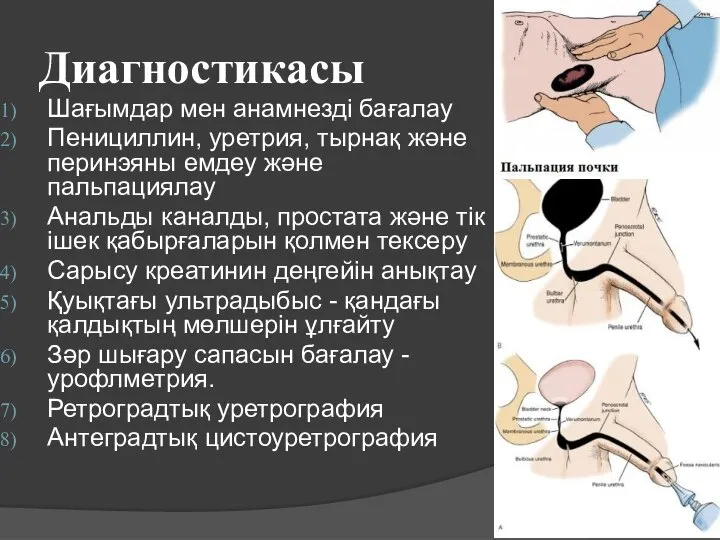 Диагностикасы Шағымдар мен анамнезді бағалау Пенициллин, уретрия, тырнақ және перинэяны емдеу және