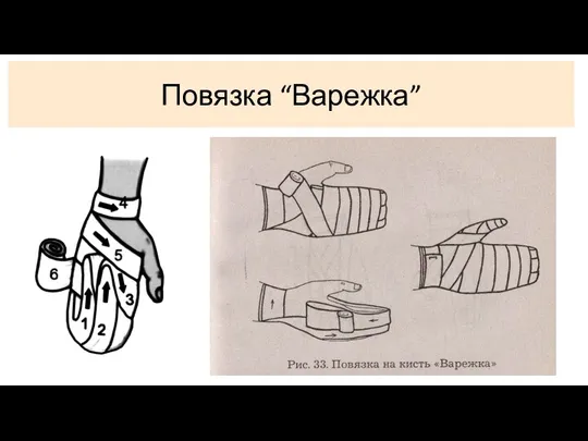 Повязка “Варежка”