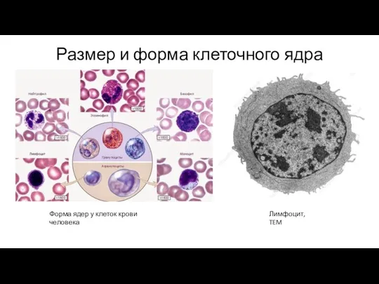Размер и форма клеточного ядра Форма ядер у клеток крови человека Лимфоцит, TEM