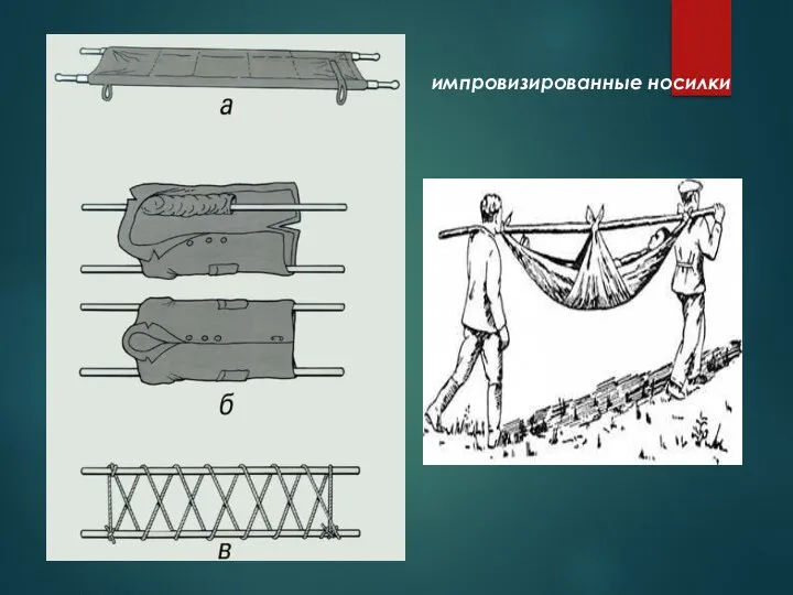 импровизированные носилки