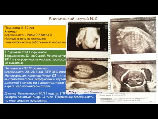 Клинический случай №2 Пациентка И. 29 лет Анамнез: Беременность 1 Роды 0