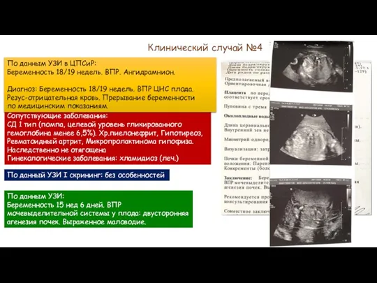 Клинический случай №4 Пациентка Е. 32 года Анамнез: Беременность 2 Роды 0