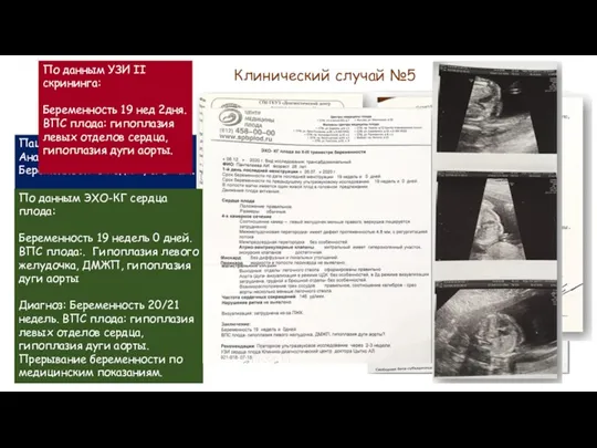 Клинический случай №5 Пациентка А. 28 лет Анамнез: Беременность 3 Роды 1,