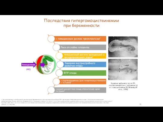 Куриные эмбрионы после 53-часовой инкубации с лейцином (а) и с гомоцистеином (б)