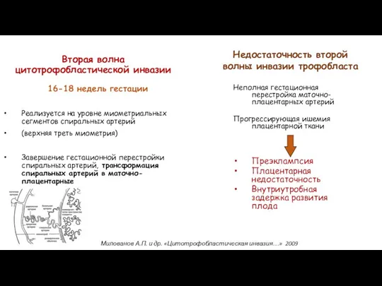 Вторая волна цитотрофобластической инвазии 16-18 недель гестации Реализуется на уровне миометриальных сегментов