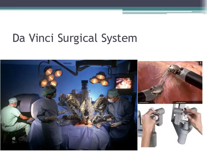 Da Vinci Surgical System