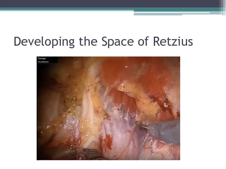 Developing the Space of Retzius
