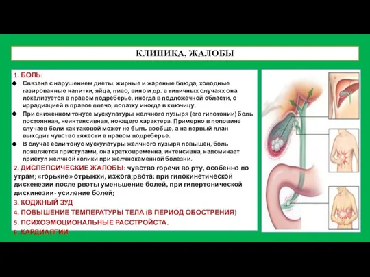 КЛИНИКА, ЖАЛОБЫ 1. БОЛЬ: Связана с нарушением диеты: жирные и жареные блюда,