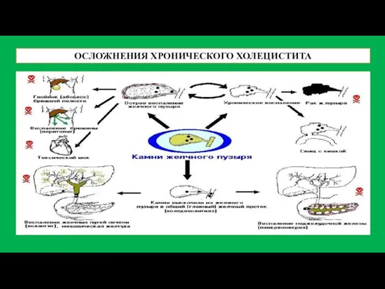 ОСЛОЖНЕНИЯ ХРОНИЧЕСКОГО ХОЛЕЦИСТИТА