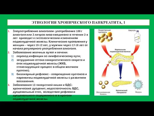 ЭТИОЛОГИЯ ХРОНИЧЕСКОГО ПАНКРЕАТИТА, 1 Злоупотребление алкоголем: употребление 100 г алкоголя или 2