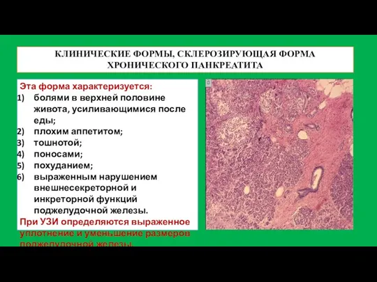 КЛИНИЧЕСКИЕ ФОРМЫ, СКЛЕРОЗИРУЮЩАЯ ФОРМА ХРОНИЧЕСКОГО ПАНКРЕАТИТА Эта форма характеризуется: болями в верхней