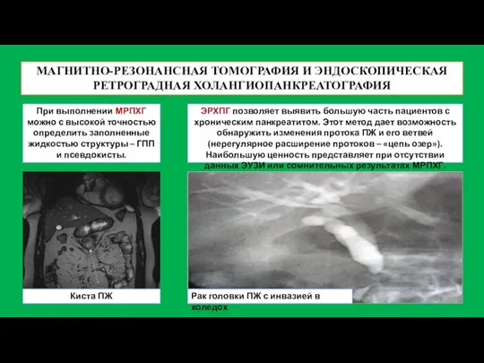 МАГНИТНО-РЕЗОНАНСНАЯ ТОМОГРАФИЯ И ЭНДОСКОПИЧЕСКАЯ РЕТРОГРАДНАЯ ХОЛАНГИОПАНКРЕАТОГРАФИЯ При выполнении МРПХГ можно с высокой