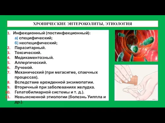 ХРОНИЧЕСКИЕ ЭНТЕРОКОЛИТЫ, ЭТИОЛОГИЯ Инфекционный (постинфекционный): а) специфический; б) неспецифический; Паразитарный. Токсический. Медикаментозный.