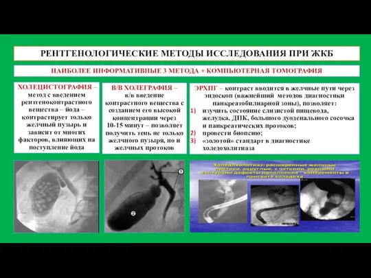 РЕНТГЕНОЛОГИЧЕСКИЕ МЕТОДЫ ИССЛЕДОВАНИЯ ПРИ ЖКБ ХОЛЕЦИСТОГРАФИЯ – метод с введением рентгеноконтрастного вещества