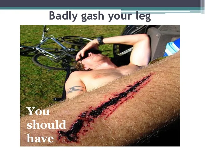 Badly gash your leg You should have stitches