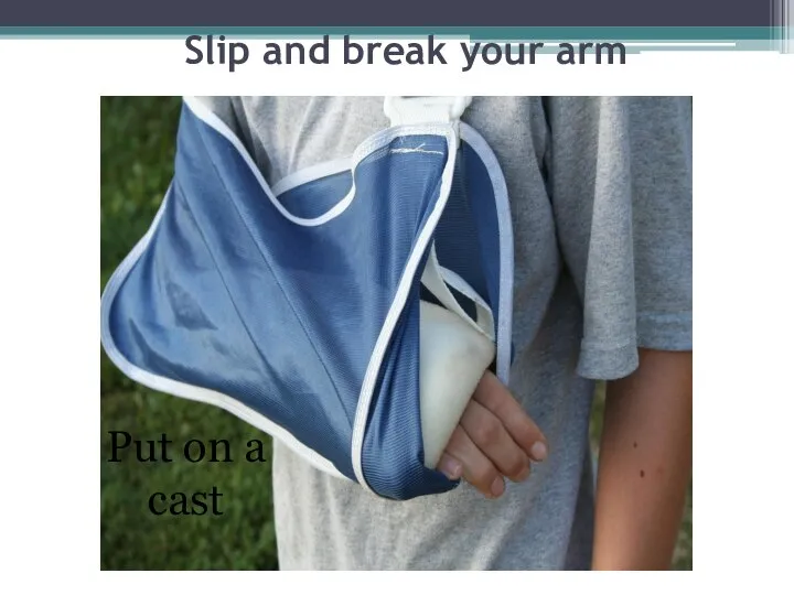 Slip and break your arm Put on a cast