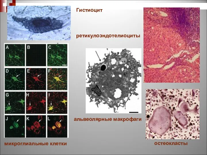 Гистиоцит ретикулоэндотелиоциты альвеолярные макрофаги остеокласты микроглиальные клетки
