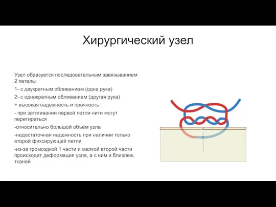 Хирургический узел Узел образуется последовательным завязыванием 2 петель: 1- с двукратным обливанием