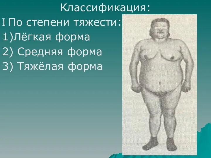 Классификация: I По степени тяжести: 1)Лёгкая форма 2) Средняя форма 3) Тяжёлая форма