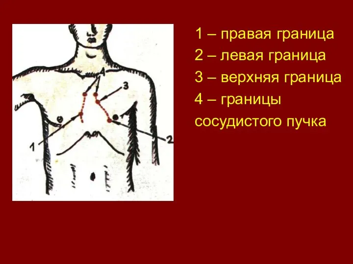 1 – правая граница 2 – левая граница 3 – верхняя граница