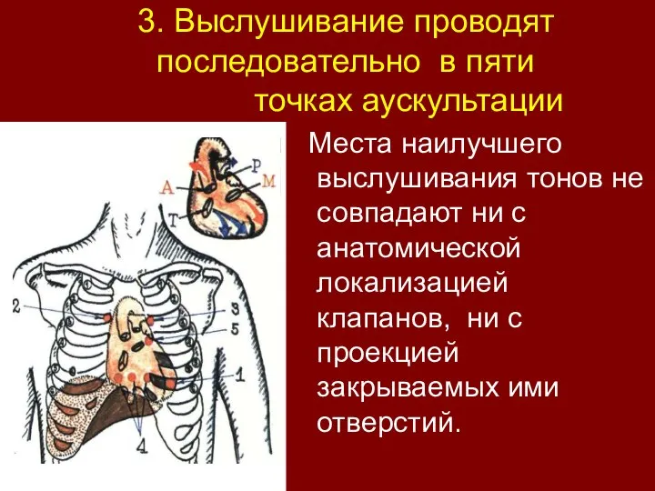 3. Выслушивание проводят последовательно в пяти точках аускультации Места наилучшего выслушивания тонов