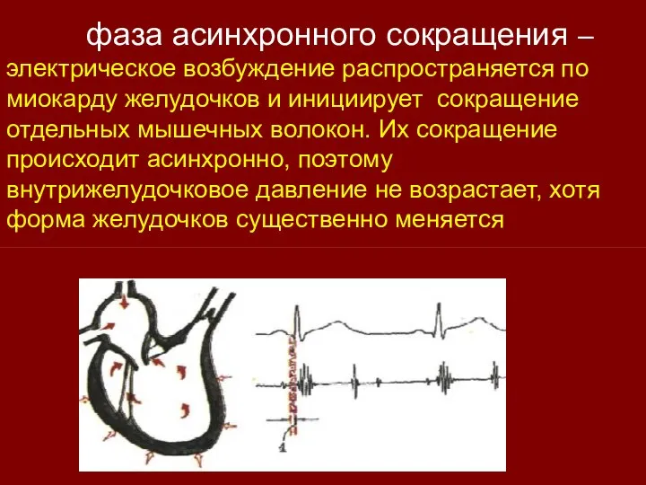 фаза асинхронного сокращения – электрическое возбуждение распространяется по миокарду желудочков и инициирует