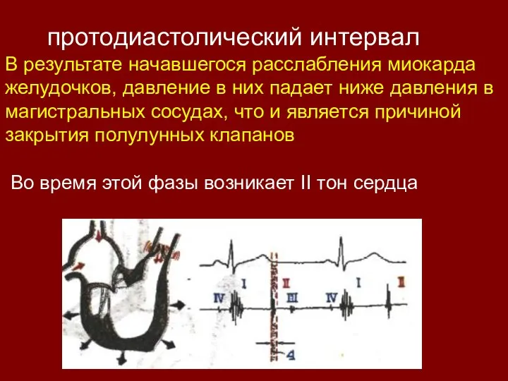 протодиастолический интервал В результате начавшегося расслабления миокарда желудочков, давление в них падает