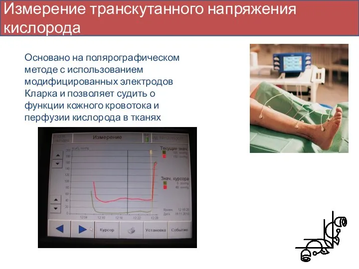 Измерение транскутанного напряжения кислорода Основано на полярографическом методе с использованием модифицированных электродов