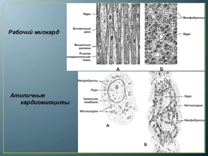 Рабочий миокард Атипичные кардиомиоциты