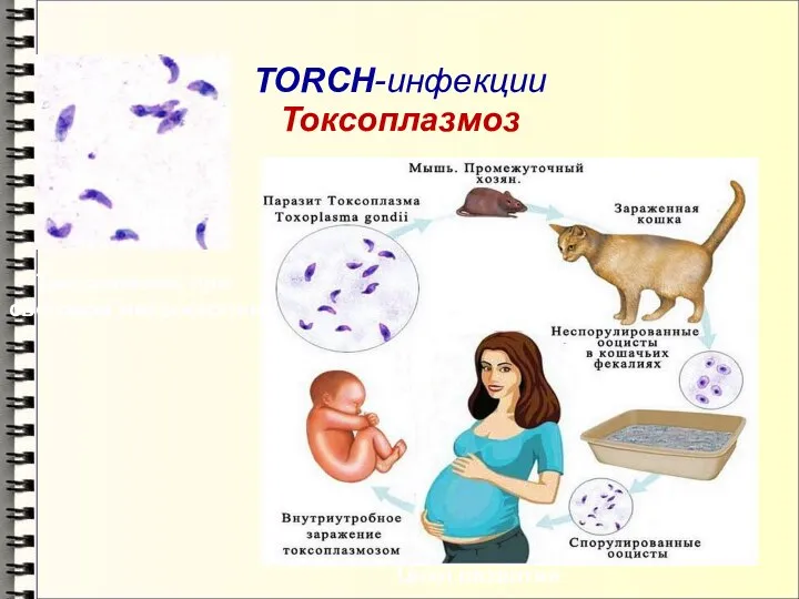 TORCH-инфекции Токсоплазмоз Цикл развития Токсоплазмы при световой микроскопии
