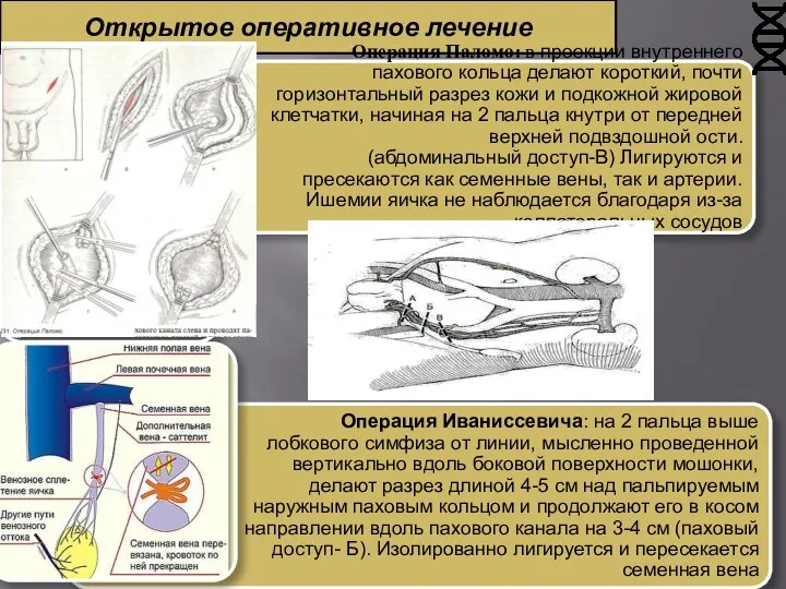 Открытое оперативное лечение