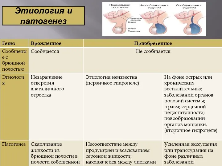 Этиология и патогенез