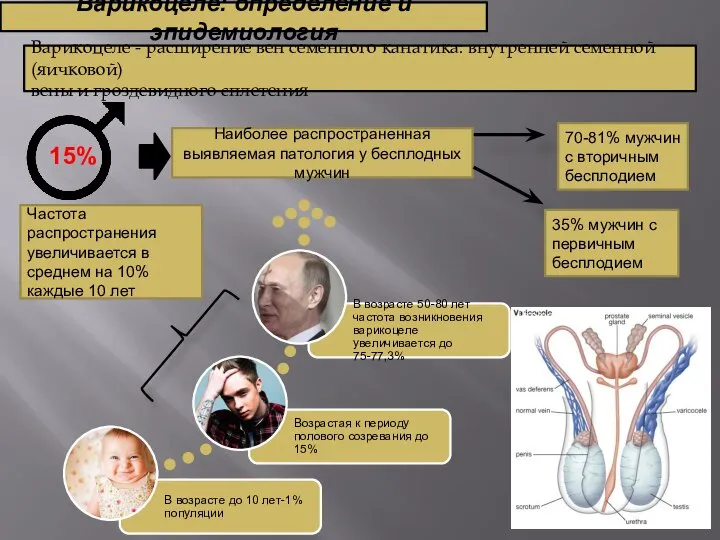 Варикоцеле - расширение вен семенного канатика: внутренней семенной (яичковой) вены и гроздевидного
