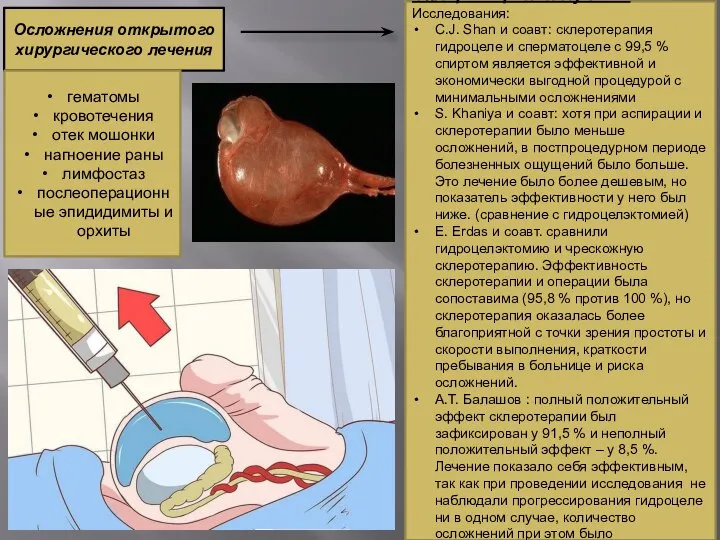 Осложнения открытого хирургического лечения гематомы кровотечения отек мошонки нагноение раны лимфостаз послеоперационные