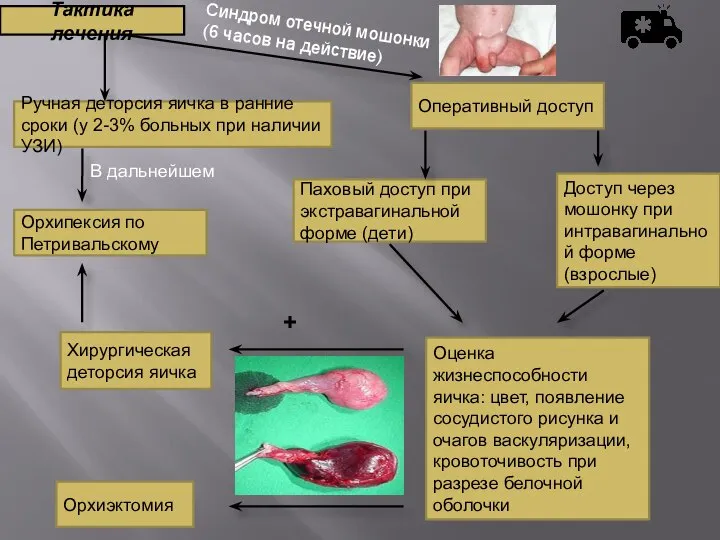 Тактика лечения Ручная деторсия яичка в ранние сроки (у 2-3% больных при