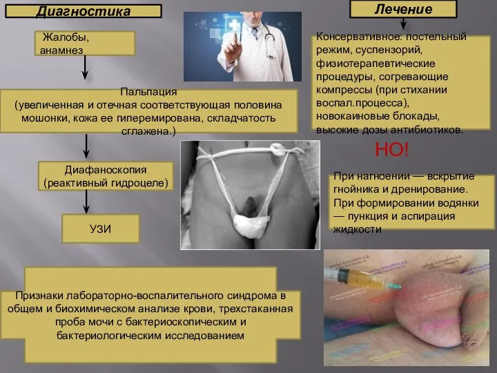 Диагностика Жалобы, анамнез Пальпация (увеличенная и отечная соответствующая половина мошонки, кожа ее