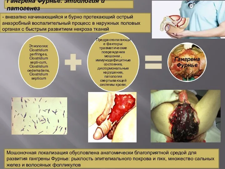 Гангрена Фурнье: этиология и патогенез - внезапно начинающийся и бурно протекающий острый