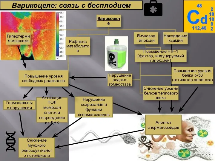 Варикоцеле: связь с бесплодием Гормональные нарушения Активация ПОЛ мембран клеток и повреждение