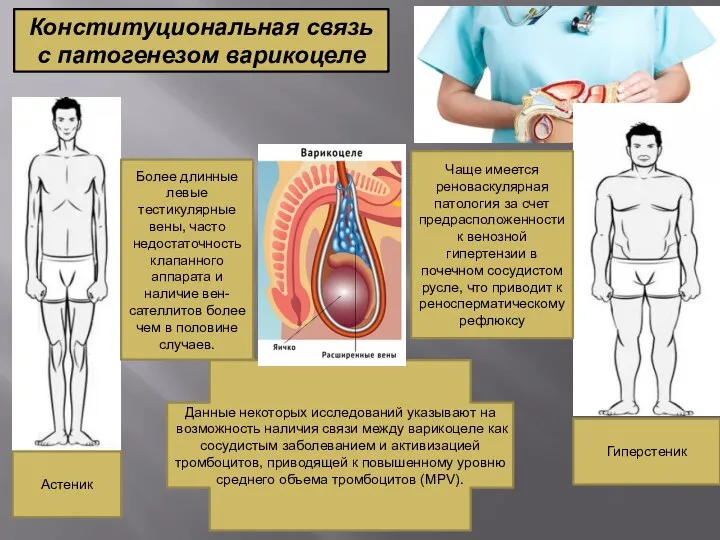 Конституциональная связь с патогенезом варикоцеле Более длинные левые тестикулярные вены, часто недостаточность