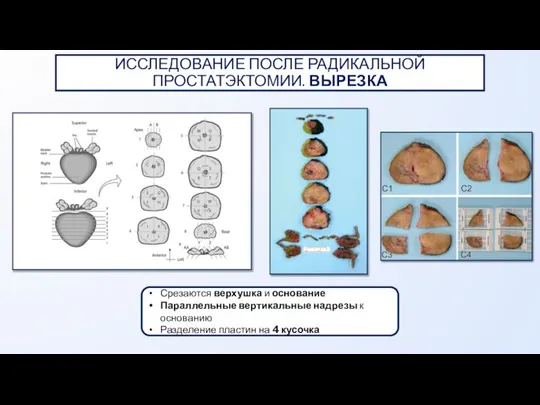 Срезаются верхушка и основание Параллельные вертикальные надрезы к основанию Разделение пластин на