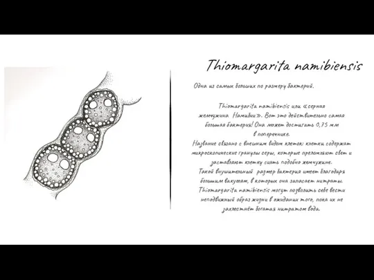 Thiomargarita namibiensis Одна из самых больших по размеру бактерий. Thiomargarita namibiensis или