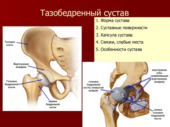 Тазобедренный сустав 1. Форма сустава 2. Суставные поверхности 3. Капсула сустава 4.