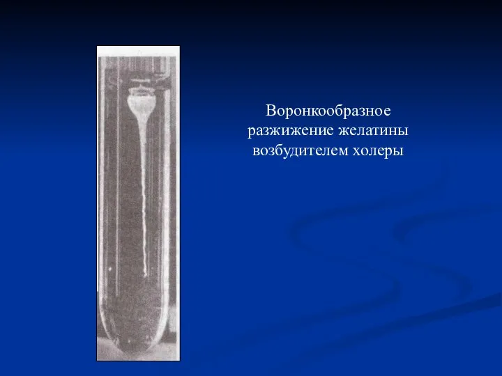 Воронкообразное разжижение желатины возбудителем холеры