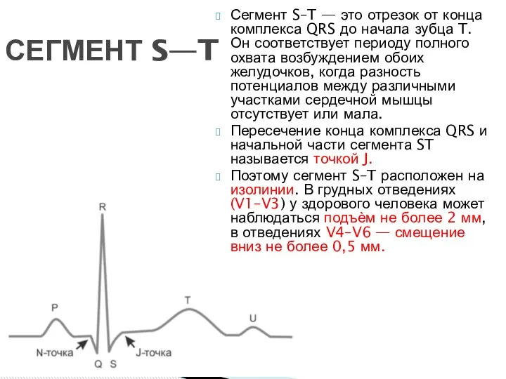 СЕГМЕНТ S—T Сегмент S–T — это отрезок от конца комплекса QRS до