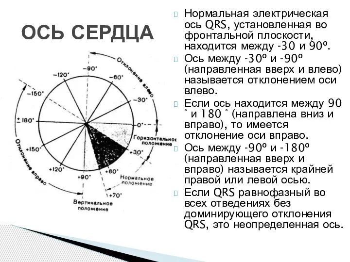 Нормальная электрическая ось QRS, установленная во фронтальной плоскости, находится между -30 и