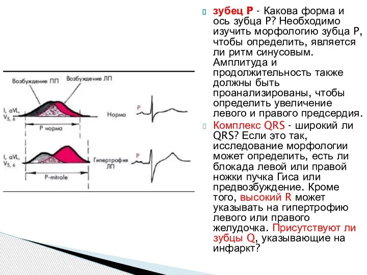 зубец P - Какова форма и ось зубца P? Необходимо изучить морфологию